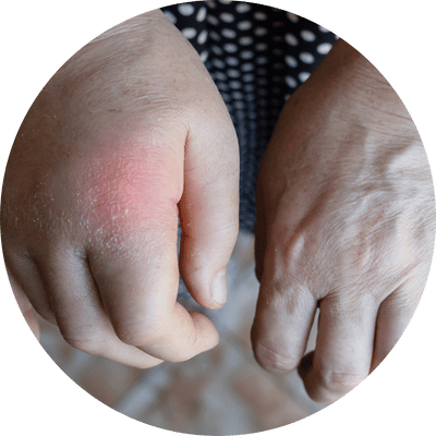 Lymfedrainage Massage is niet voor iedereen geschikt. Lees wat Bewuster en Gezonder uit Kesteren vertelt.